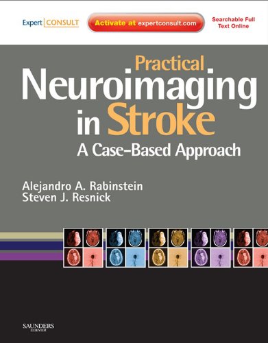 Practical Neuroimaging in Stroke: A Case-Based Approach. Saunders Elsevier, 2009.